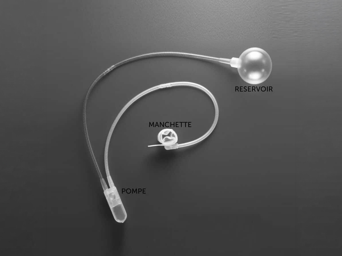 2. sphincter artificiel urinaire ams 800 600x596