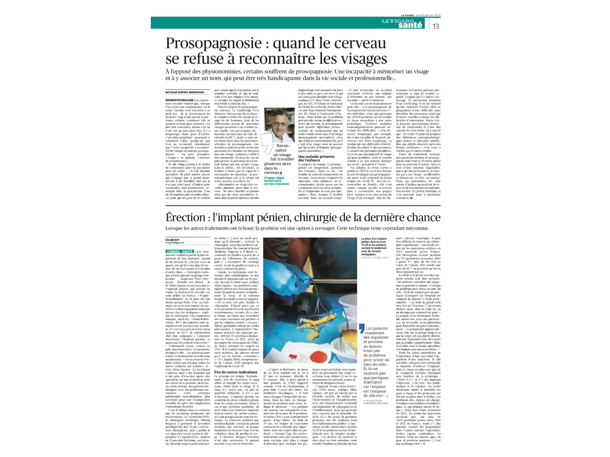 article figaro implant penien 1 article figaro implant penien 1