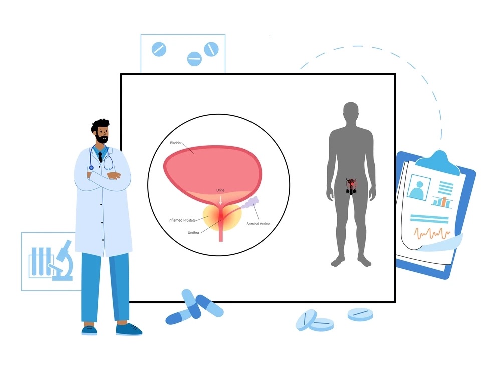 examen prostate