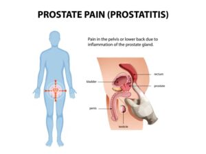 zone ou se situe prostate homme