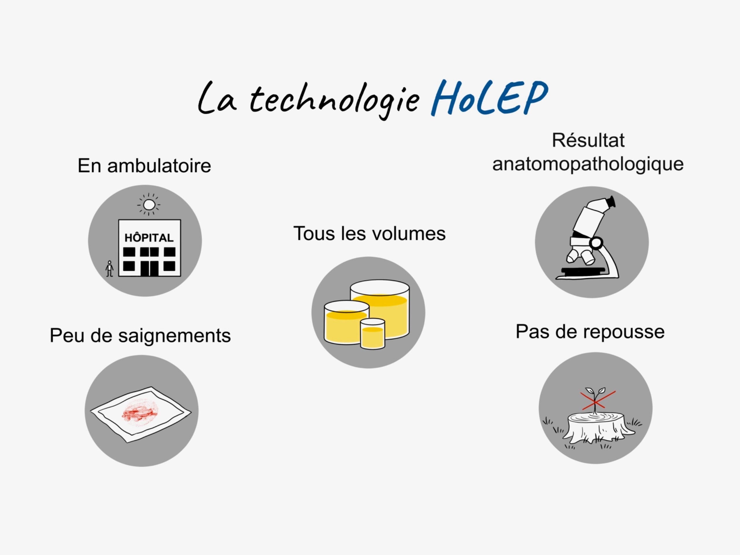 5 avantages de la technologie holep 600x399 5 avantages de la technologie holep 600x399
