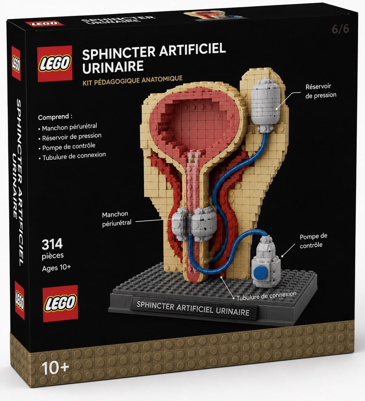 Incontinence urinaire majeure corrigée par la pose d'un sphincter urinaire artificiel AMS 800