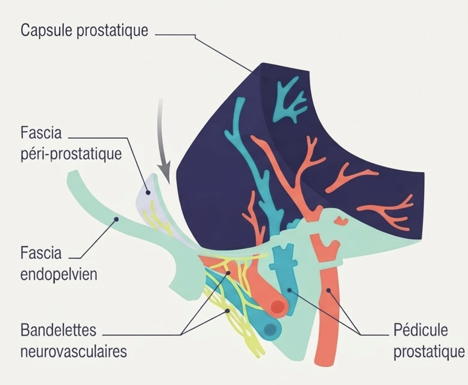 La préservation nerveuse intra- fasciale