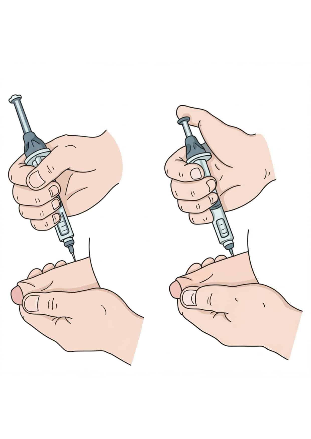 Injection intracaverneuse d'EDEX